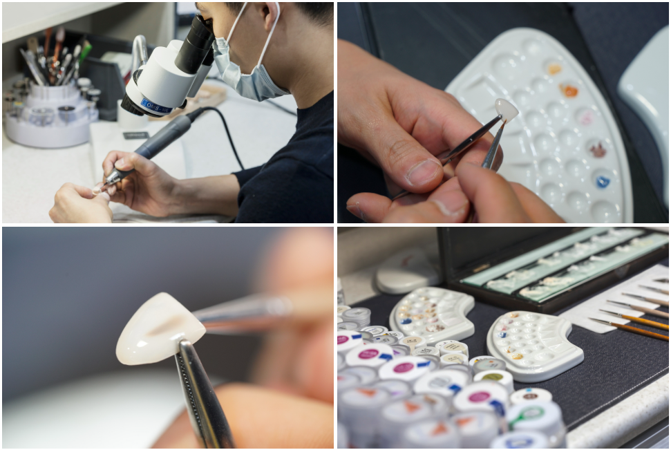 블랙필름 가압주조 공정 — 왁스업에서 세라믹 프레싱까지