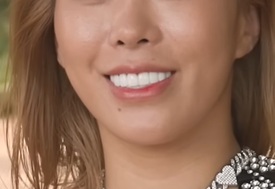 라 본문 두번째 이미지 - 무삭제 라미네이트 90%가 후회한다는데 진짜 이유는?